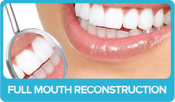 Full mouth reconstruction-Dr.Rudy dental care