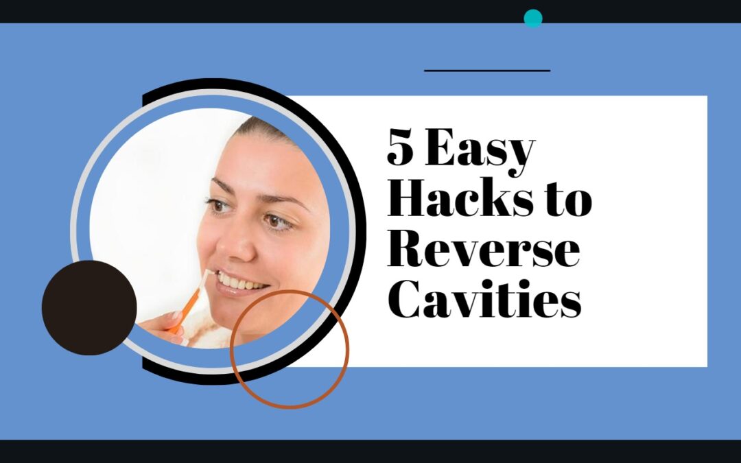 5 Easy Hacks to Reverse Cavities
