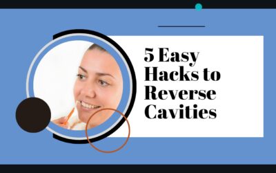 5 Easy Hacks to Reverse Cavities