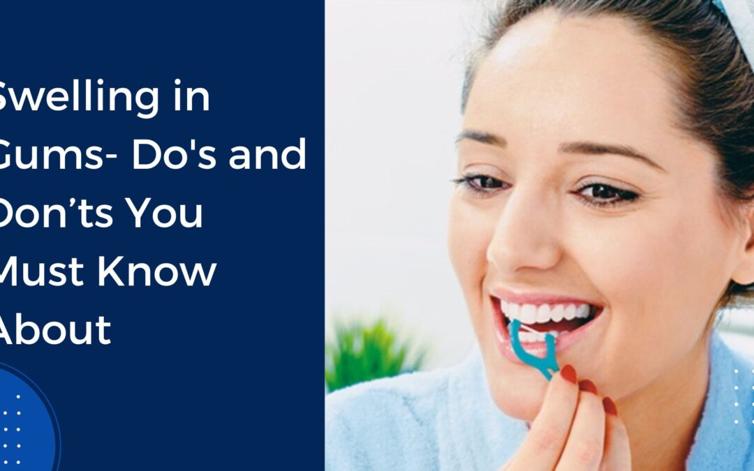 Swelling in Gums- Do’s and Don’ts You Must Know About